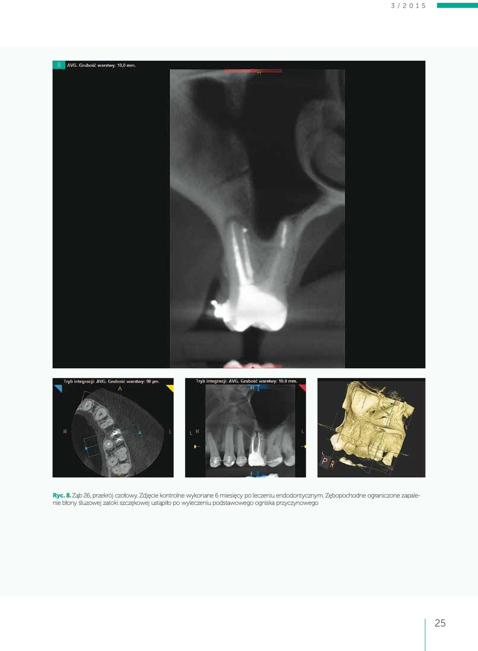 endodontycznym.