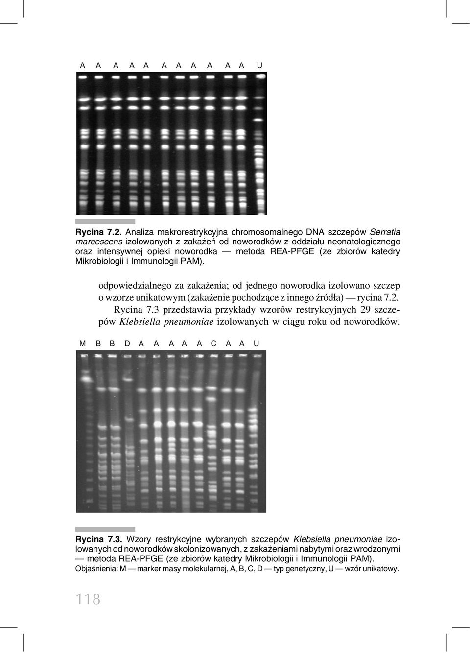 zbioro w katedry Mikrobiologii i Immunologii PAM). odpowiedzialnego za zakaz enia; od jednego noworodka izolowano szczep o wzorze unikatowym (zakaz enie pochodza ce z innego z ro dła) rycina 7.2.