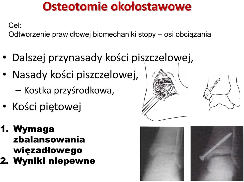 piszczelowej, Nasady kości piszczelowej, Kostka