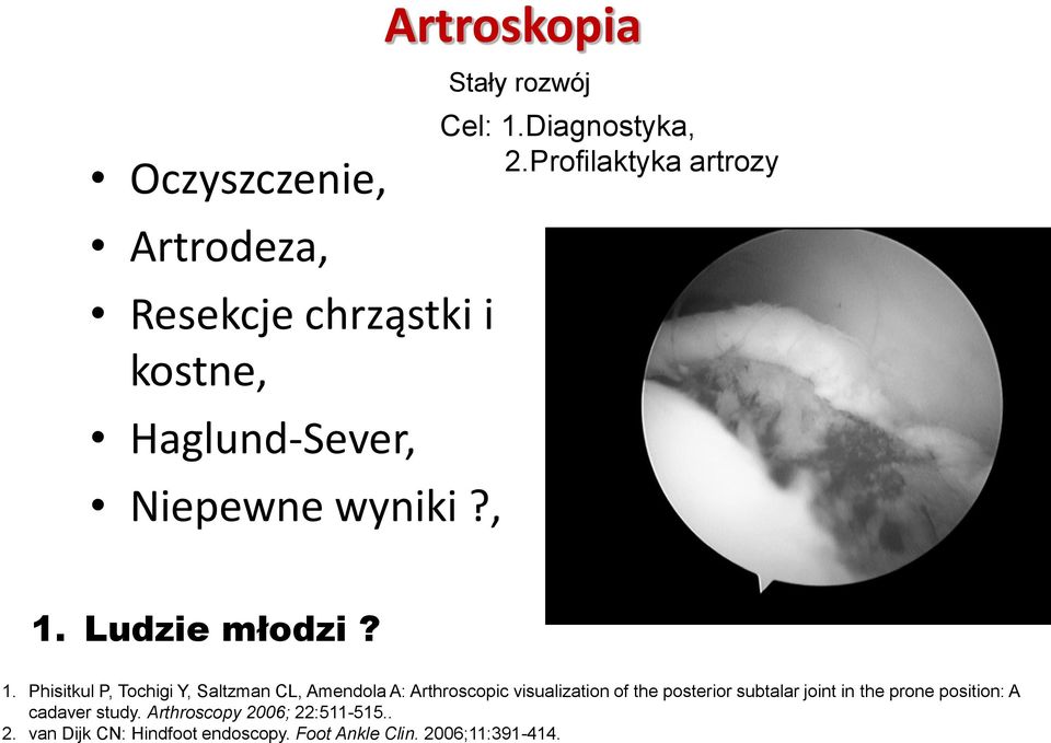 Diagnostyka, 2.Profilaktyka artrozy 1.