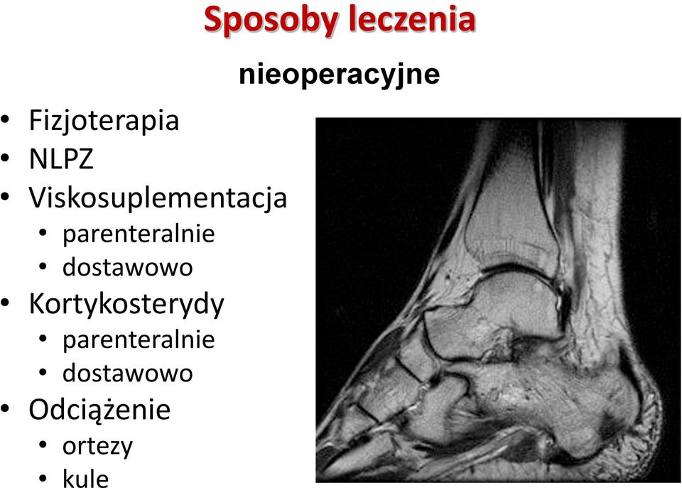 parenteralnie dostawowo Odciążenie