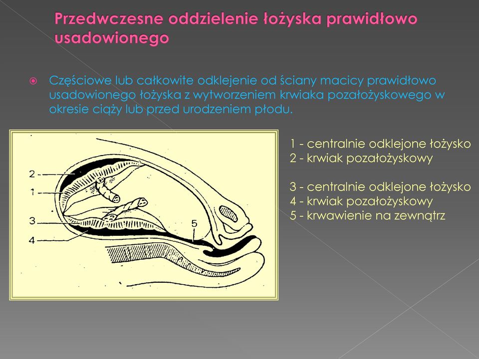 urodzeniem płodu.