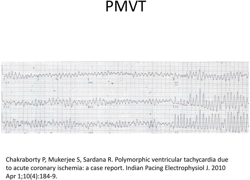 acute coronary ischemia: a case report.