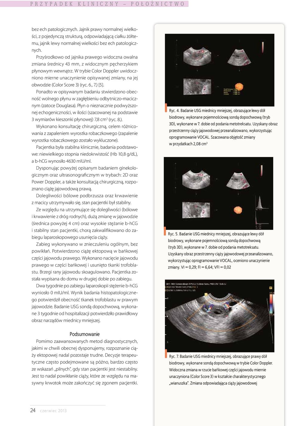 W trybie Color Doppler uwidoczniono mierne unaczynienie opisywanej zmiany, na jej obwodzie (Color Score 3) (ryc. 6., 7.) [5].