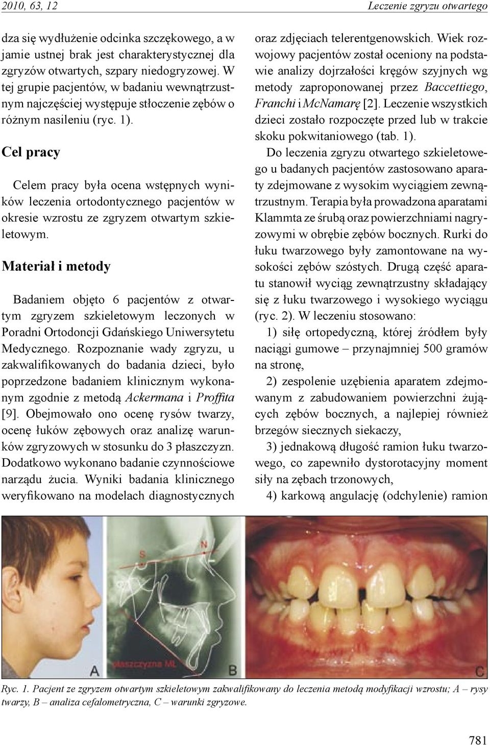 Cel pracy Celem pracy była ocena wstępnych wyników leczenia ortodontycznego pacjentów w okresie wzrostu ze zgryzem otwartym szkieletowym.