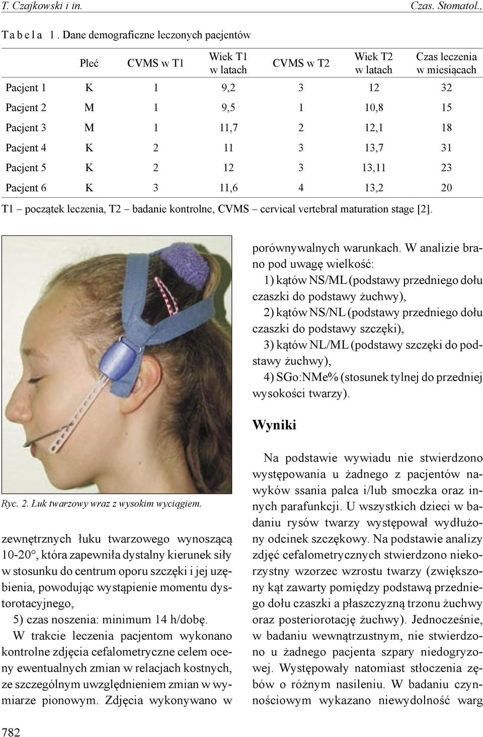 12,1 18 Pacjent 4 K 2 11 3 13,7 31 Pacjent 5 K 2 12 3 13,11 23 Pacjent 6 K 3 11,6 4 13,2 20 T1 początek leczenia, T2 badanie kontrolne, CVMS cervical vertebral maturation stage [2].