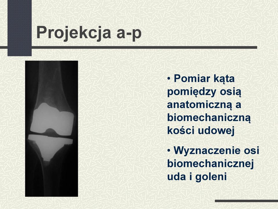 biomechaniczną kości udowej