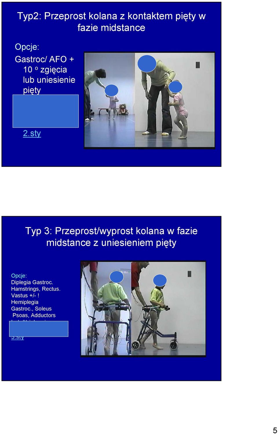 sty Typ 3: Przeprost/wyprost kolana w fazie midstance z uniesieniem pięty Opcje: Diplegia