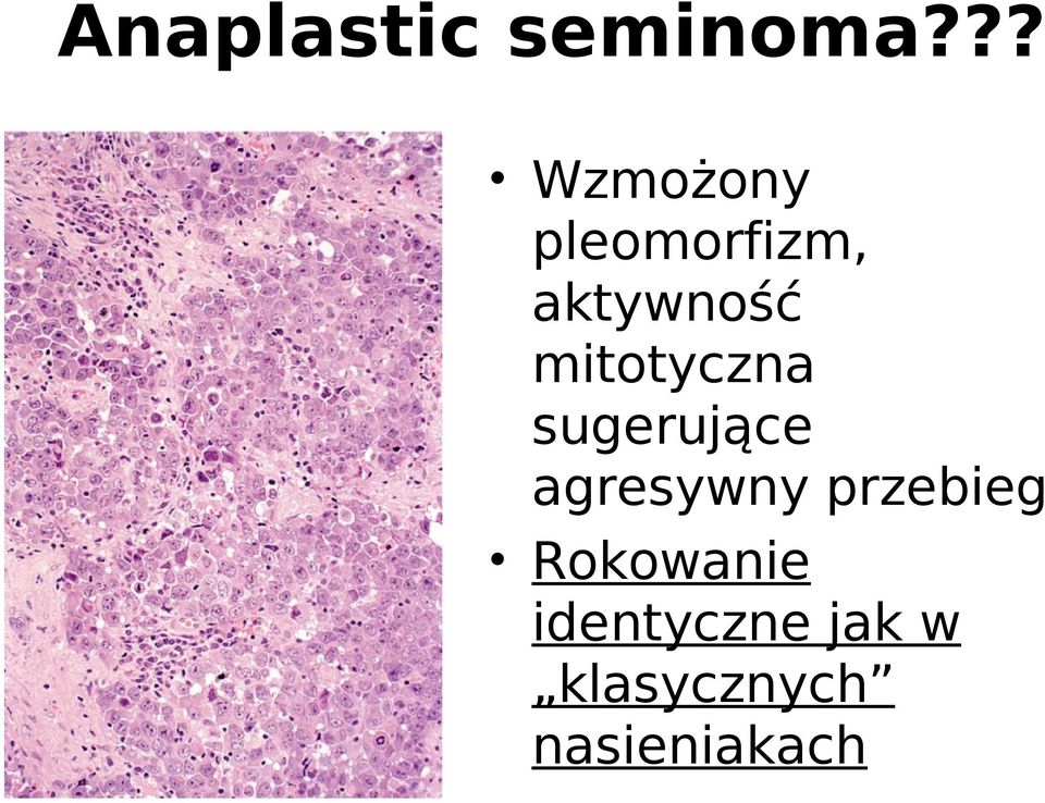 mitotyczna sugerujące agresywny