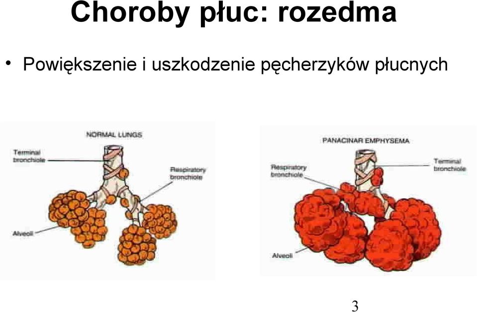 Powiększenie i