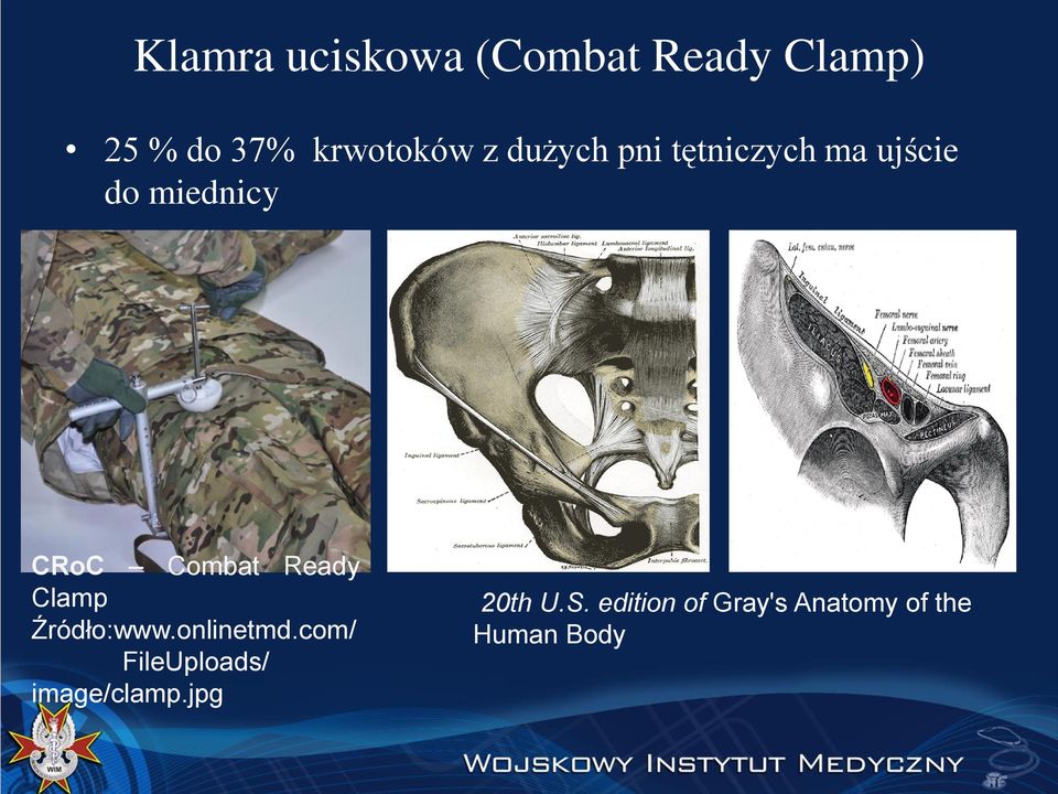 Ready Clamp Źródło:www.onlinetmd.