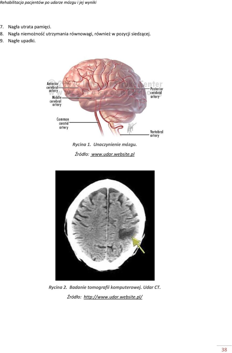 siedzącej. 9. Nagłe upadki. Rycina 1. Unaczynienie mózgu.