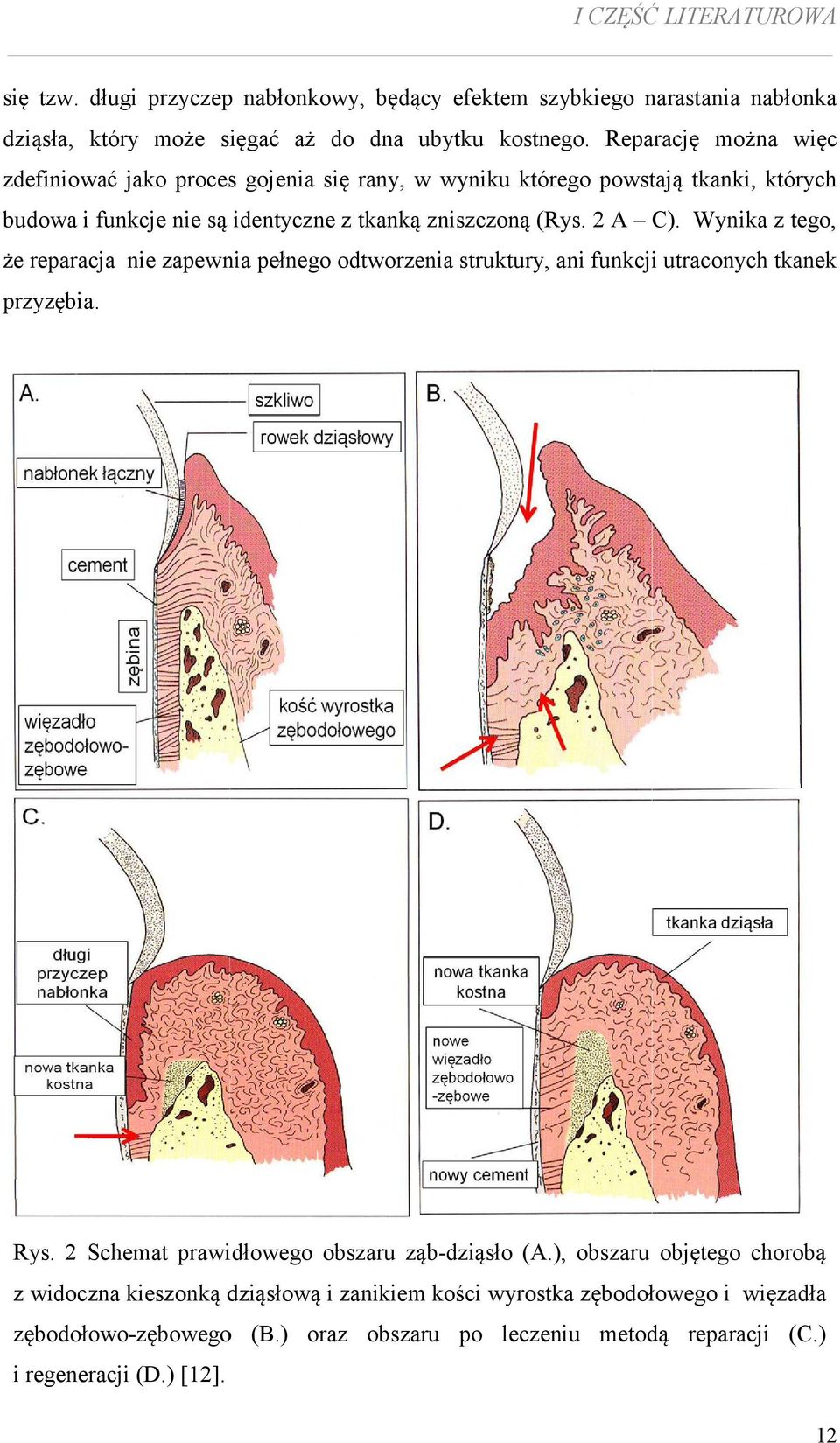 Wynika z tego, że reparacja nie zapewnia pełnego odtworzenia struktury, ani funkcji utraconych tkanek przyzębia. Rys. 2 Schemat prawidłowego obszaru ząb-dziąsło (A.