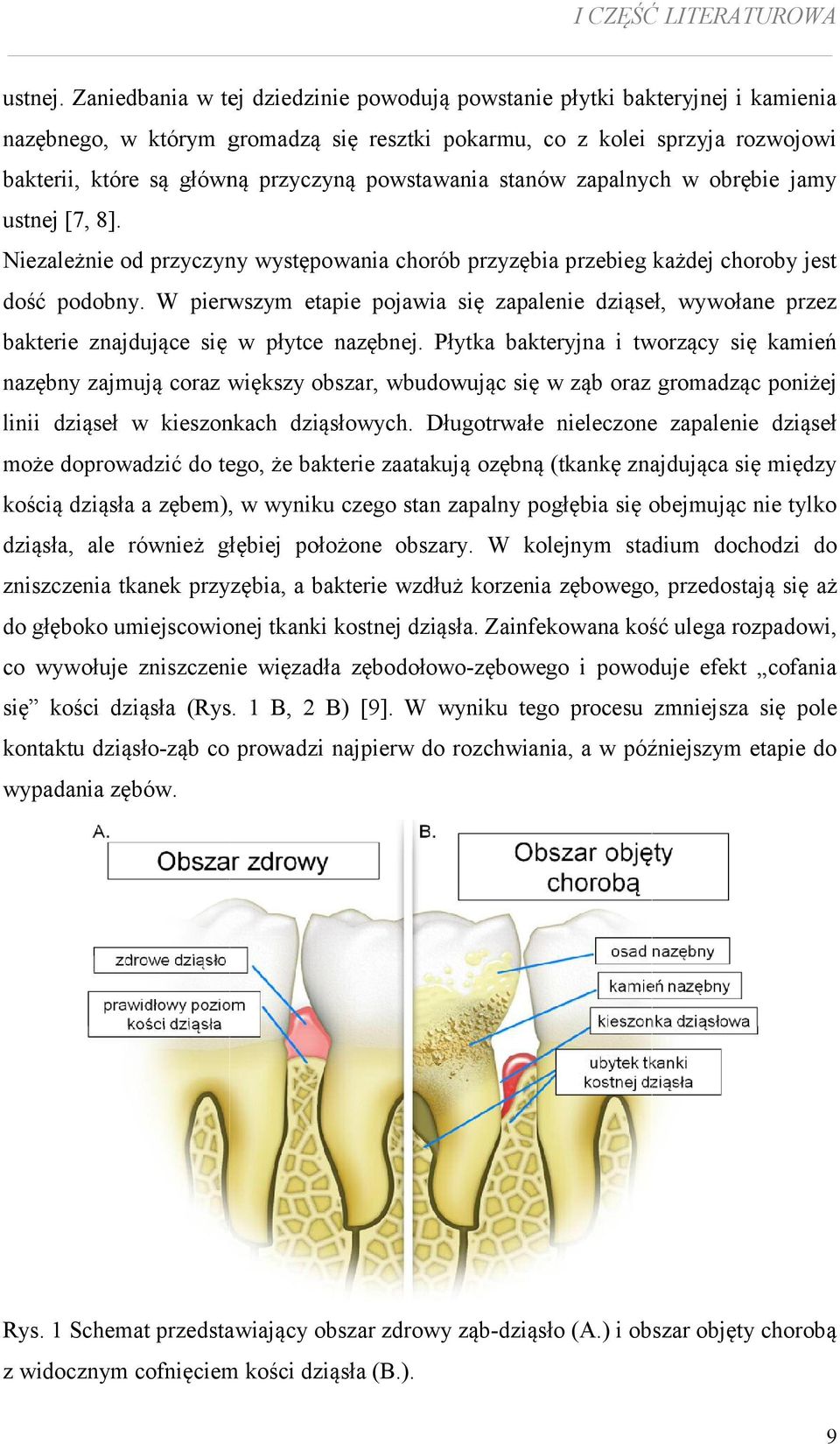 powstawania stanów zapalnych w obrębie jamy ustnej [7, 8]. Niezależnie od przyczyny występowania chorób przyzębia przebieg każdej choroby jest dość podobny.