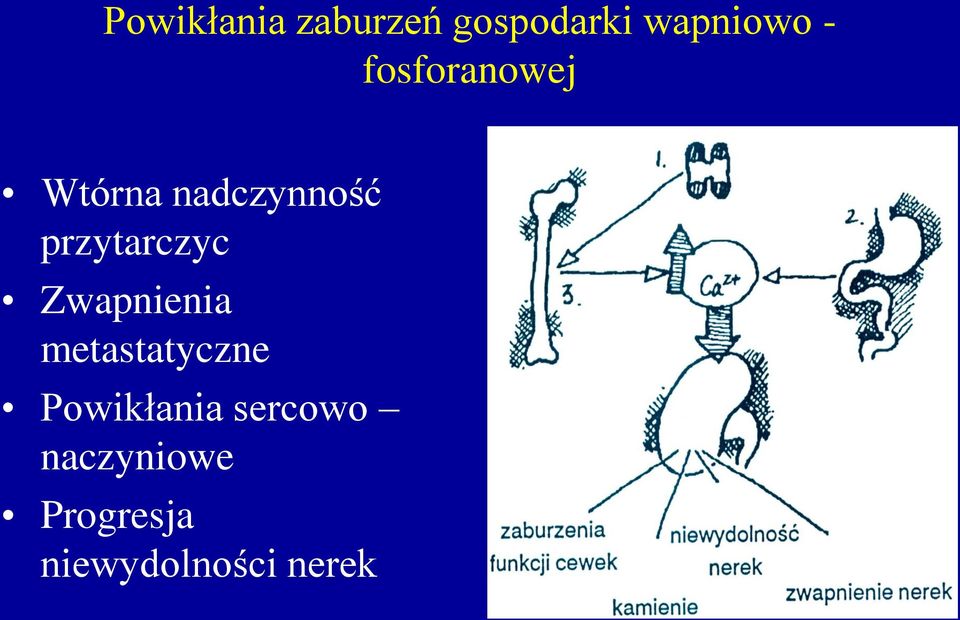 przytarczyc Zwapnienia metastatyczne