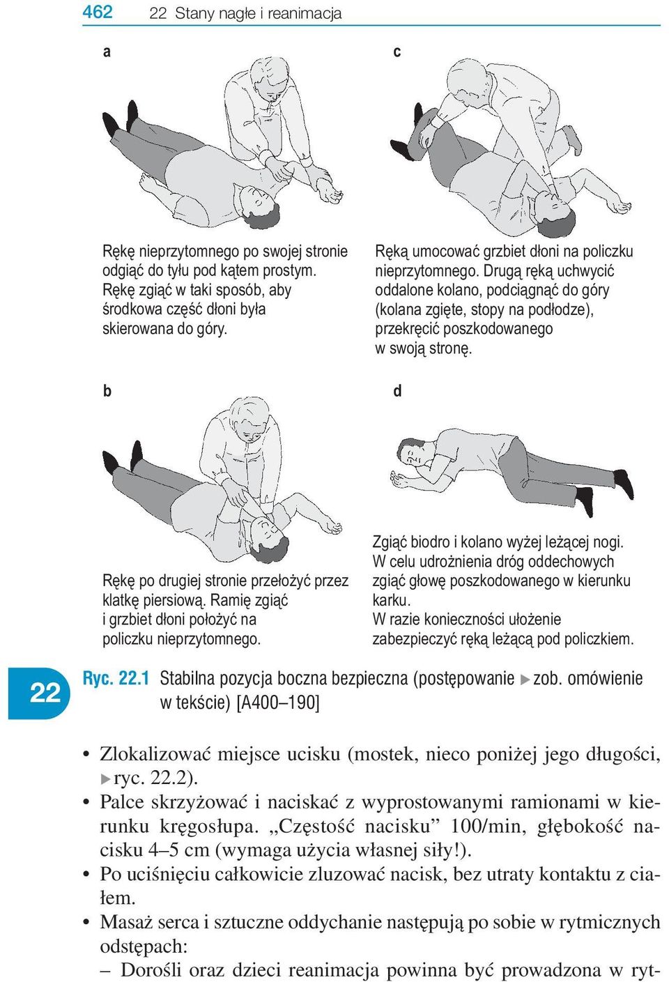 d Rękę po drugiej stronie przełożyć przez klatkę piersiową. Ramię zgiąć i grzbiet dłoni położyć na policzku nieprzytomnego. Zgiąć biodro i kolano wyżej leżącej nogi.