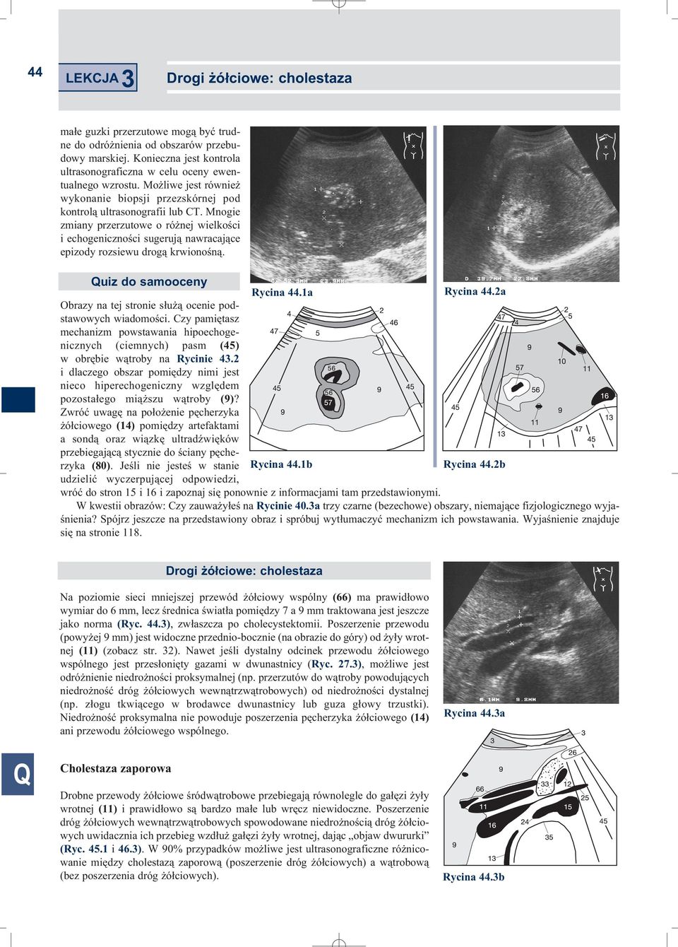 Mnogie zmiany przerzutowe o różnej wielkości i echogeniczności sugerują nawracające epizody rozsiewu drogą krwionośną. uiz do samooceny Rycina 44.1a Rycina 44.