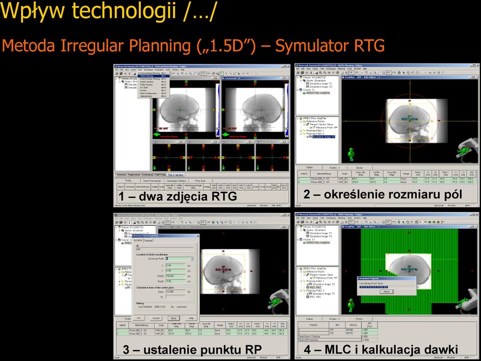 5D ) Symulator RTG 1 dwa zdjęcia RTG 3