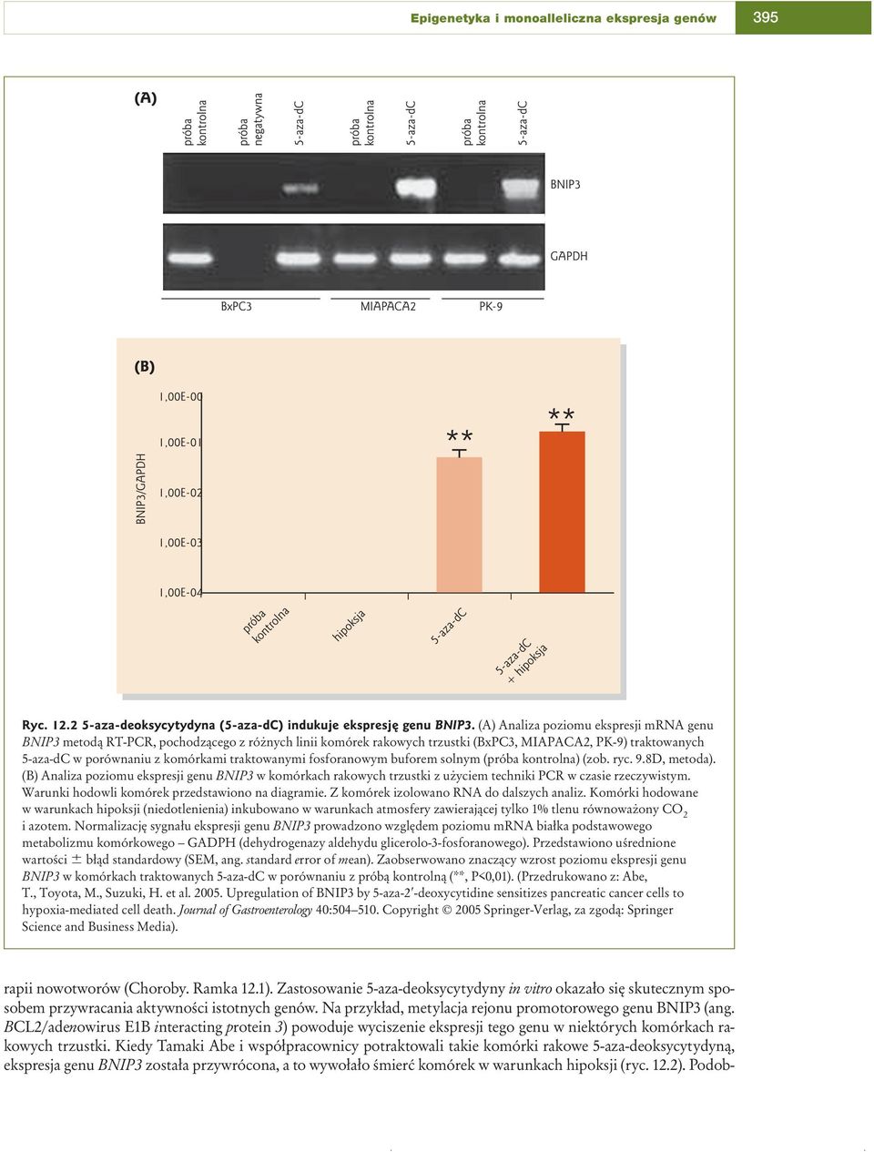 fosforanowym buforem solnym (próba kontrolna) (zob. ryc. 9.8D, metoda). (B) Analiza poziomu ekspresji genu BNIP3 w komórkach rakowych trzustki z użyciem techniki PCR w czasie rzeczywistym.