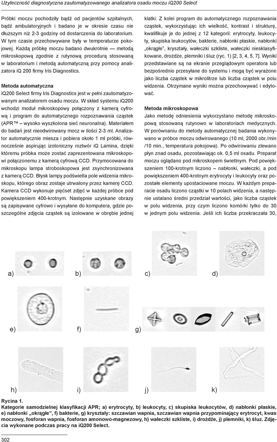 Każdą próbkę moczu badano dwukrotnie metodą mikroskopową zgodnie z rutynową procedurą stosowaną w laboratorium i metodą automatyczną przy pomocy analizatora iq 200 firmy Iris Diagnostics.