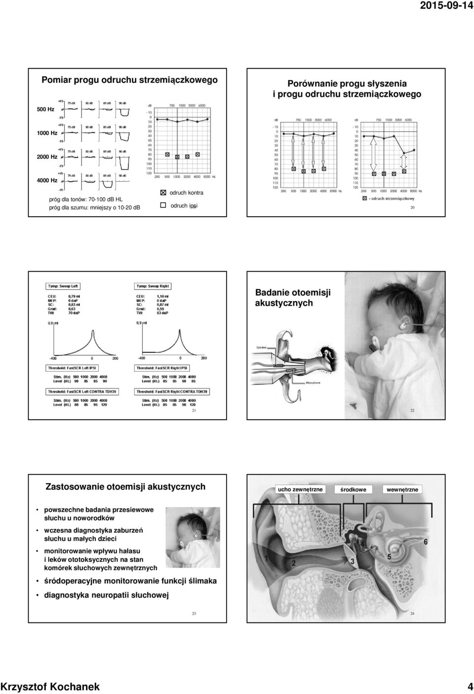 wewnętrzne powszechne badania przesiewowe słuchu u noworodków wczesna diagnostyka zaburzeń słuchu u małych dzieci monitorowanie wpływu hałasu i leków