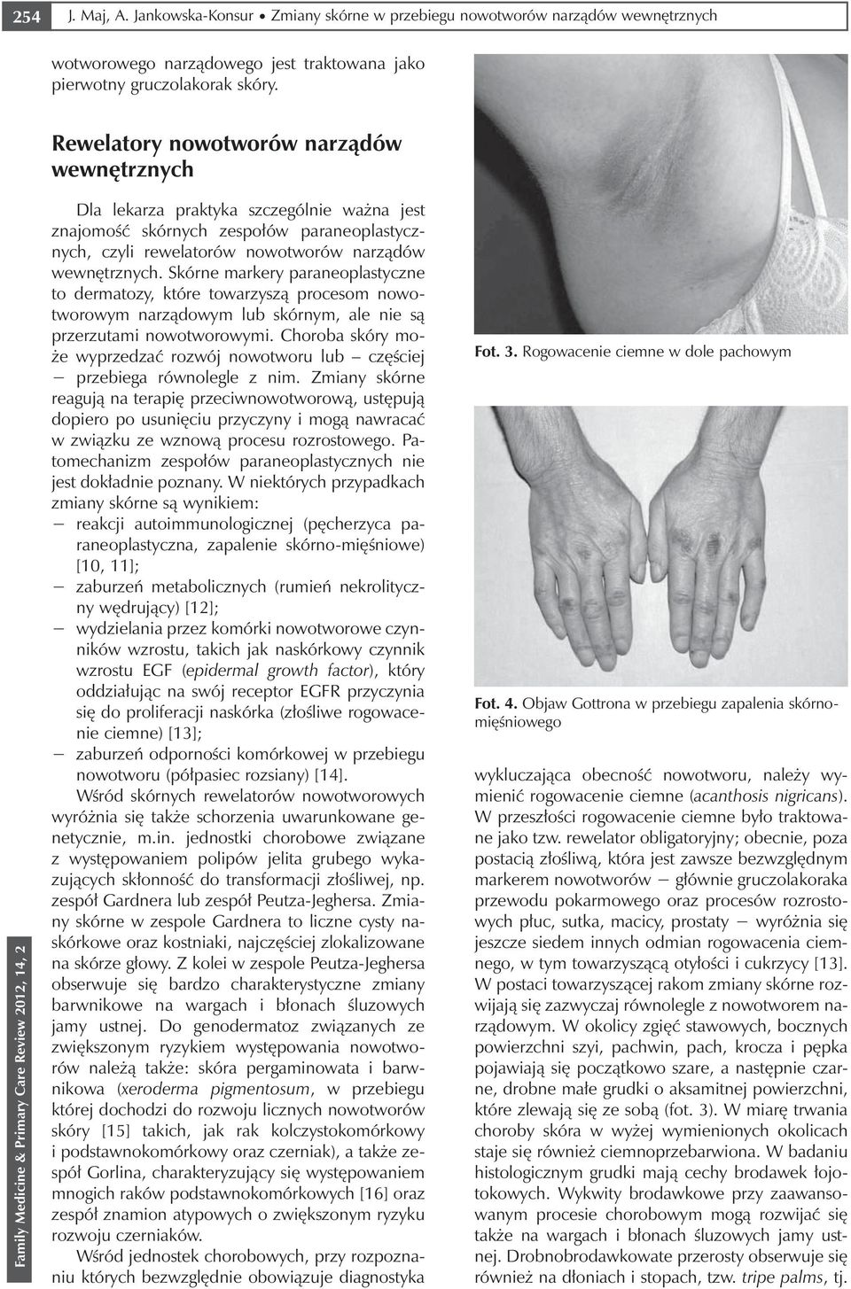 Skórne markery paraneoplastyczne to dermatozy, które towarzyszą procesom nowotworowym narządowym lub skórnym, ale nie są przerzutami nowotworowymi.