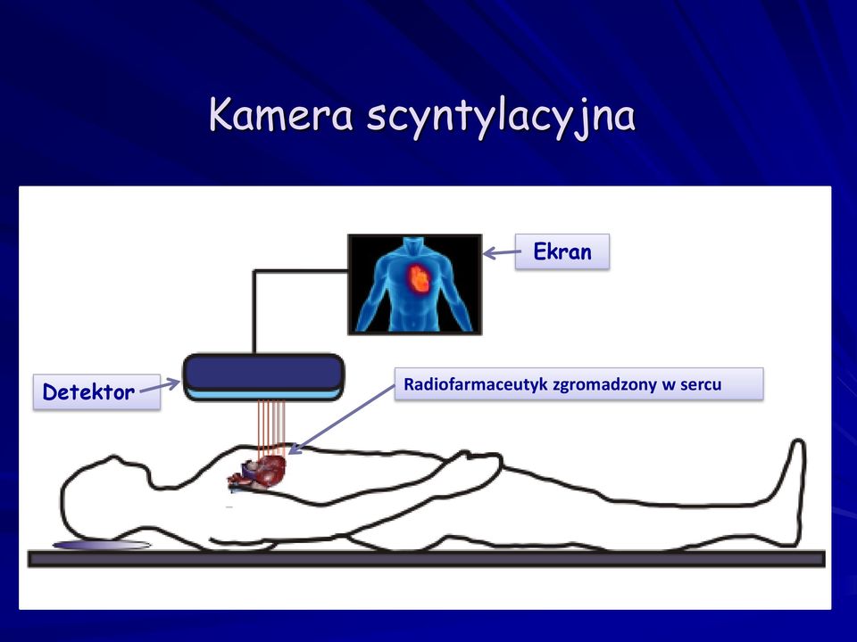 Ekran Detektor