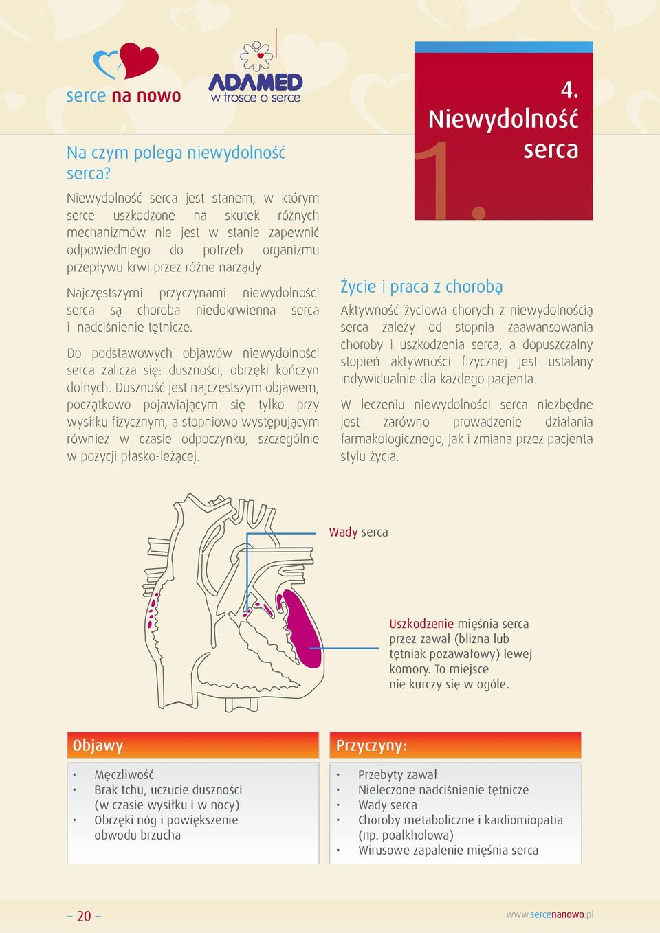 Najczęstszymi przyczynami niewydolności serca są choroba niedokrwienna serca i nadciśnienie tętnicze. Do podstawowych objawów niewydolności serca zalicza się: duszności, obrzęki kończyn dolnych.