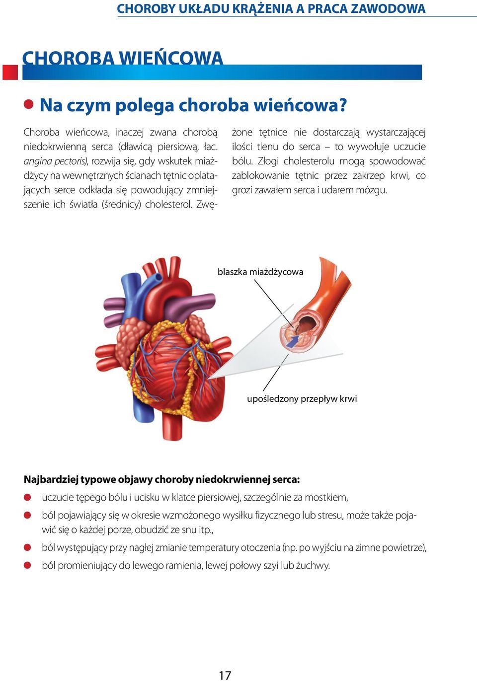 Zwę- żone tętnice nie dostarczają wystarczającej ilości tlenu do serca to wywołuje uczucie bólu.