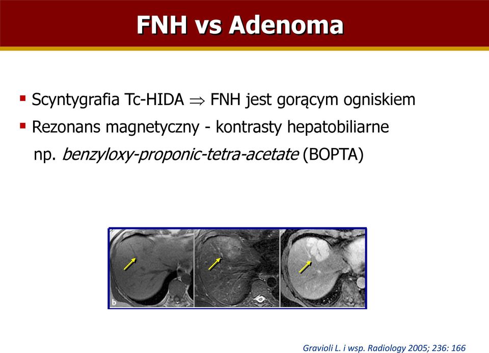 kontrasty hepatobiliarne np.