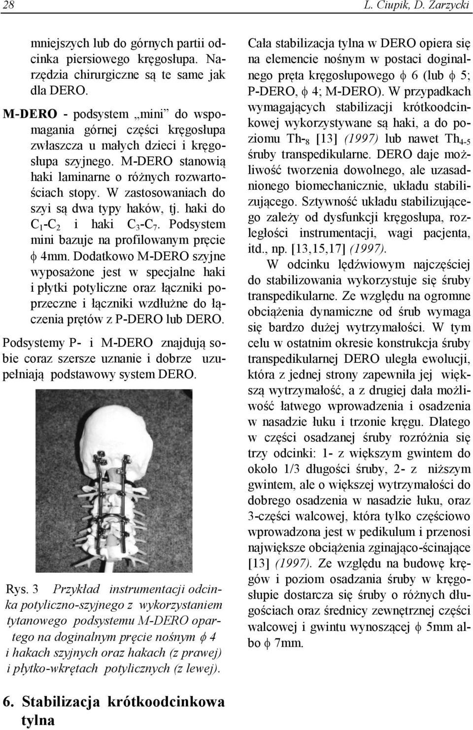 W zastosowaniach do szyi są dwa typy haków, tj. haki do C 1 -C 2 i haki C 3 -C 7. Podsystem mini bazuje na profilowanym pręcie 4mm.