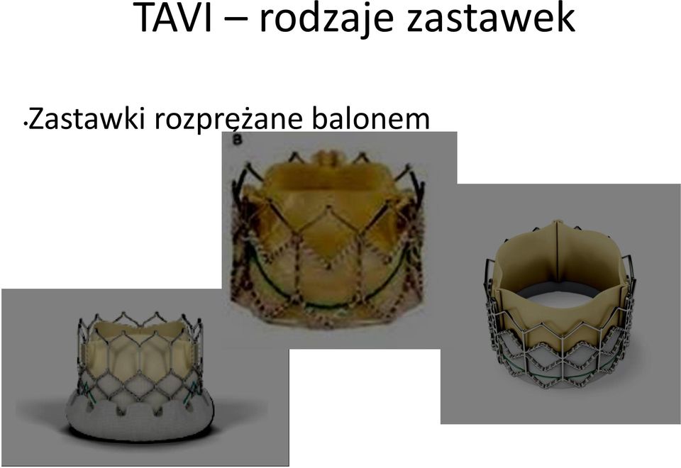 Zastawki