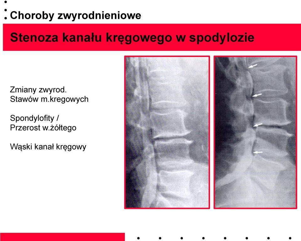 zwyrod. Stawów m.