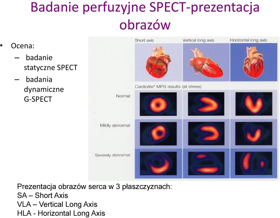 Prezentacja obrazów serca w 3 płaszczyznach: SA