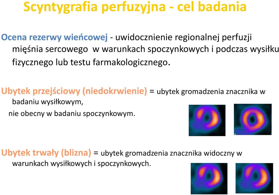 Ubytek przejściowy (niedokrwienie) = ubytek gromadzenia znacznika w badaniu wysiłkowym, nie obecny w