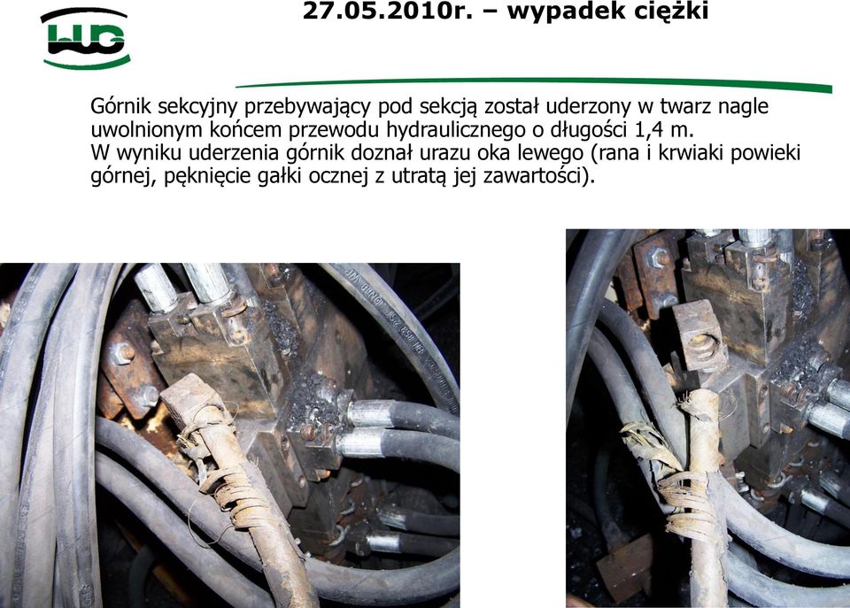 twarz nagle uwolnionym końcem przewodu hydraulicznego o długości 1,4 m.