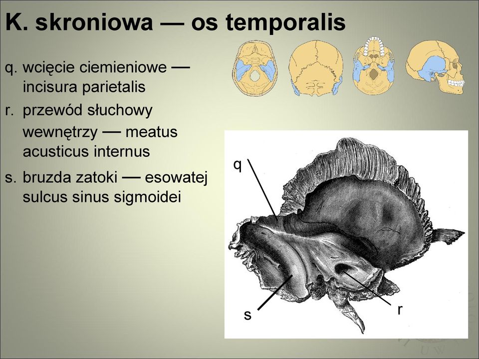 przewód słuchowy wewnętrzy meatus acusticus