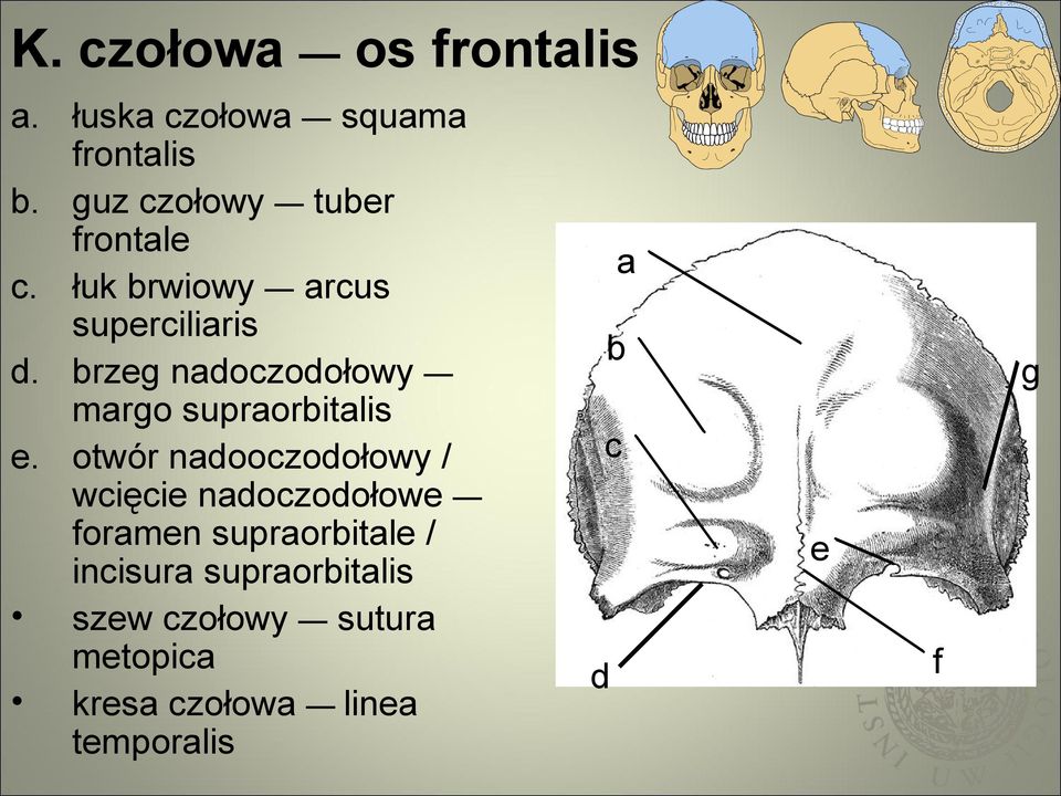 brzeg nadoczodołowy margo supraorbitalis e.