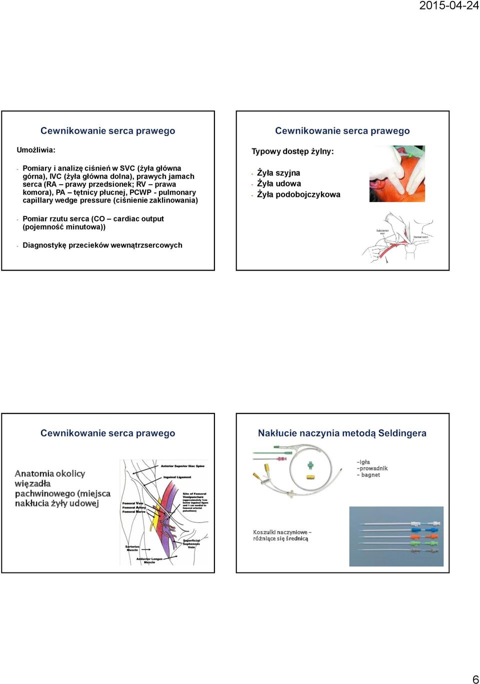 output (pojemność minutowa)) - Diagnostykę przecieków wewnątrzsercowych Typowy dostęp żylny: - Żyła szyjna - Żyła udowa - Żyła