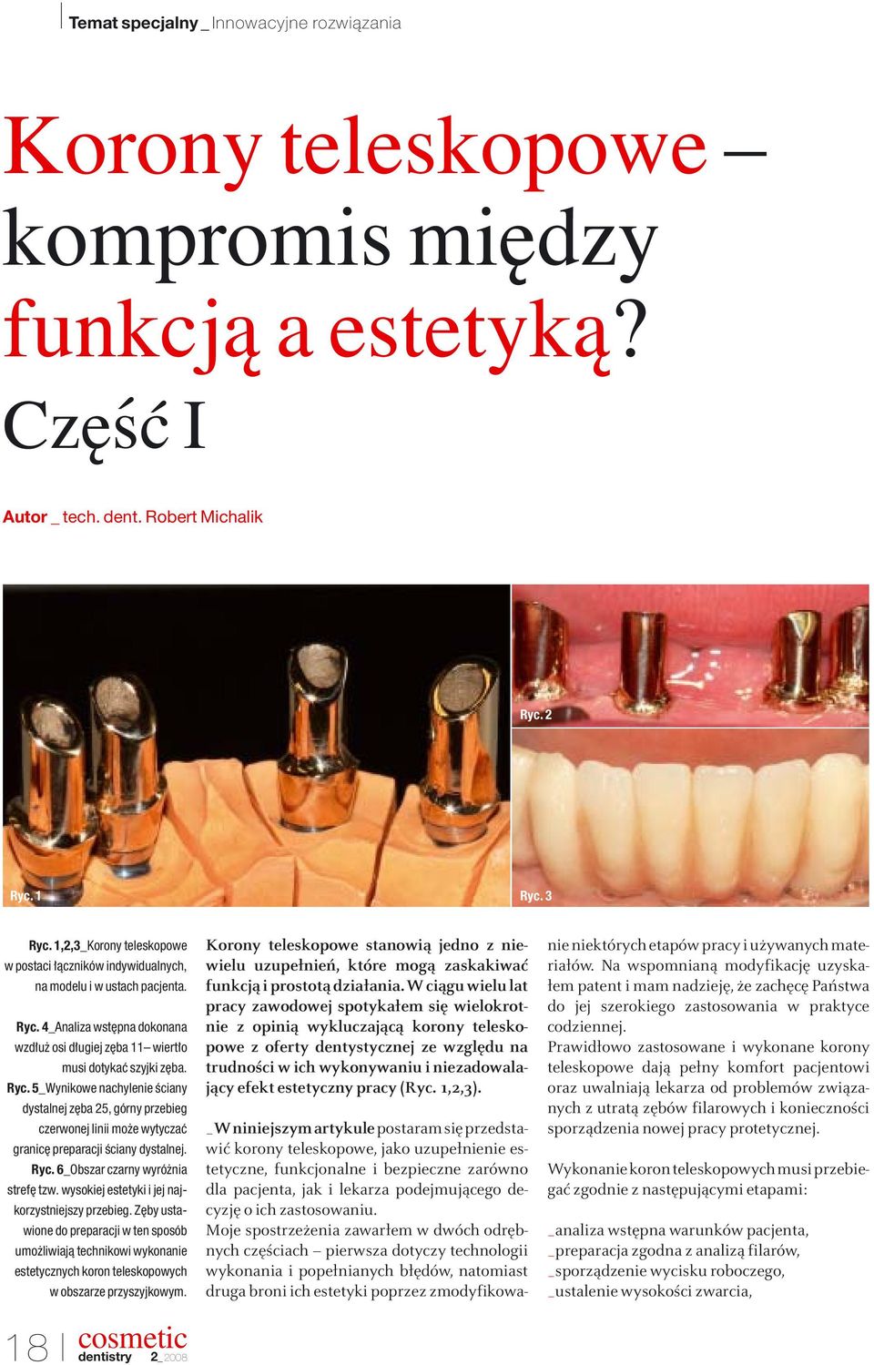 4_Analiza wst pna dokonana wzd u osi d ugiej z ba 11 wiert o musi dotykaç szyjki z ba. Ryc.