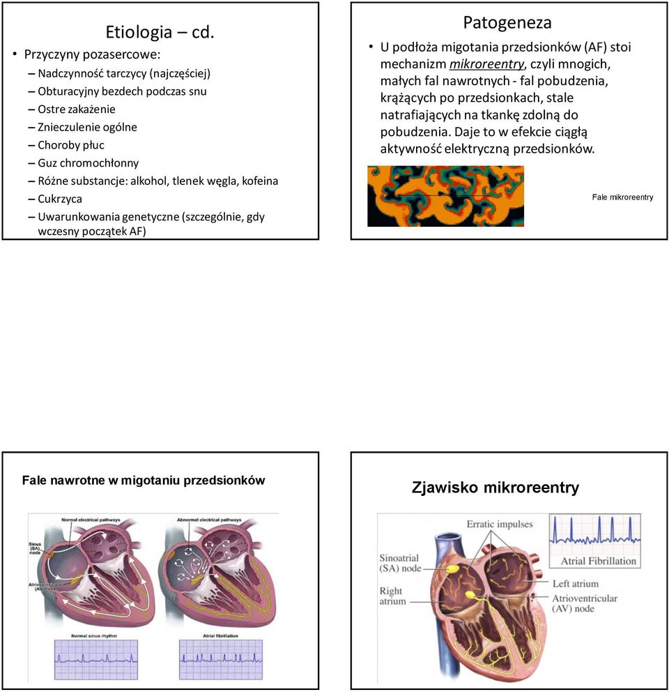Różne substancje: alkohol, tlenek węgla, kofeina Cukrzyca Uwarunkowania genetyczne (szczególnie, gdy wczesny początek AF) Patogeneza U podłoża migotania