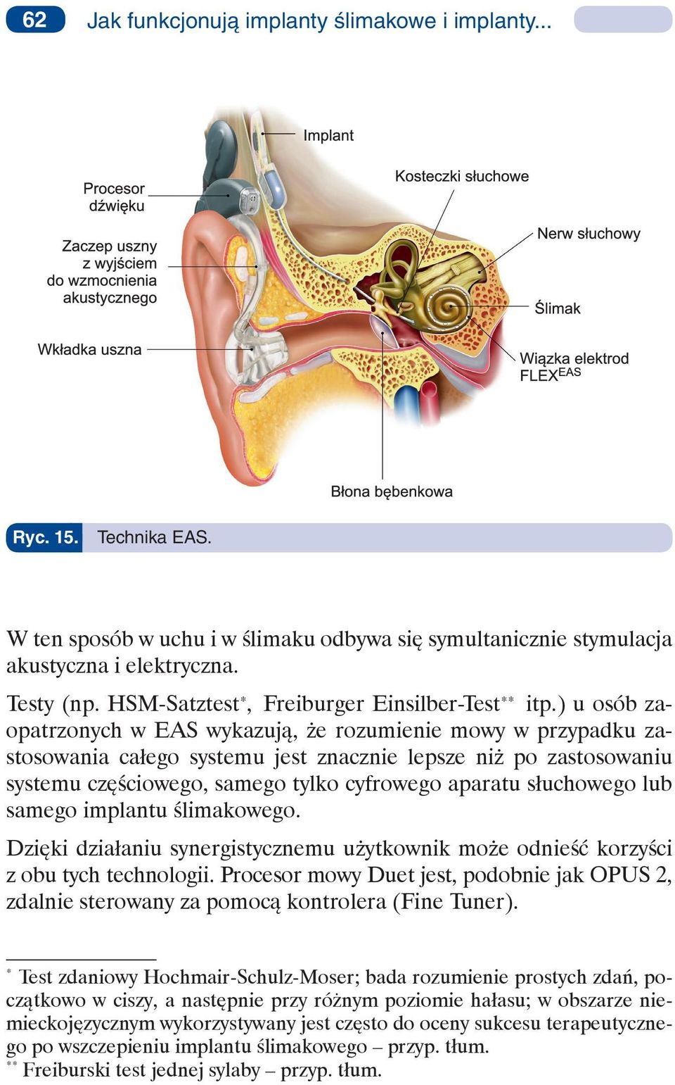 ) u osób zaopatrzonych w EAS wykazują, że rozumienie mowy w przypadku zastosowania całego systemu jest znacznie lepsze niż po zastosowaniu systemu częściowego, samego tylko cyfrowego aparatu