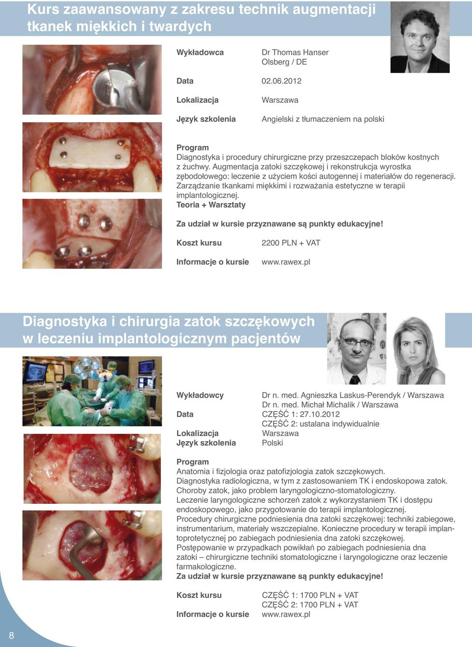 Augmentacja zatoki szczękowej i rekonstrukcja wyrostka zębodołowego: leczenie z użyciem kości autogennej i materiałów do regeneracji.