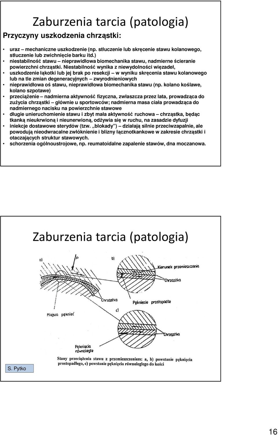 Niestabilność wynika z niewydolności więzadeł, uszkodzenie łąkotki lub jej brak po resekcji w wyniku skręcenia stawu kolanowego lub na tle zmian degeneracyjnych zwyrodnieniowych nieprawidłowa oś