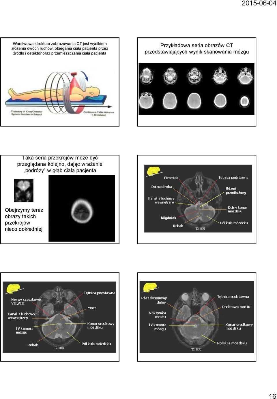 CT przedstawiających wynik skanowania mózgu Taka seria przekrojów może być przeglądana kolejno,
