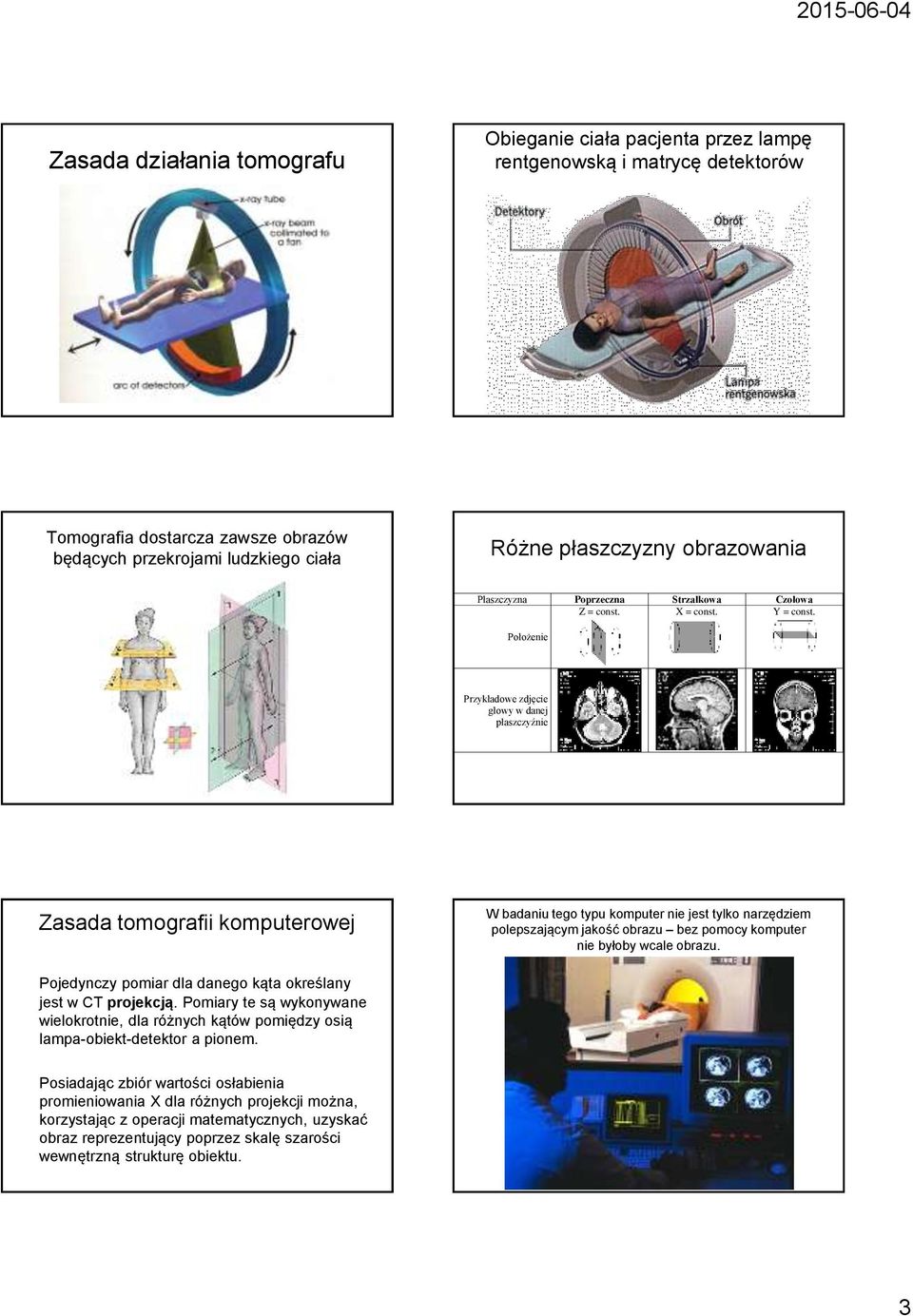 Położenie Przykładowe zdjęcie głowy w danej płaszczyźnie Zasada tomografii komputerowej W badaniu tego typu komputer nie jest tylko narzędziem polepszającym jakość obrazu bez pomocy komputer nie