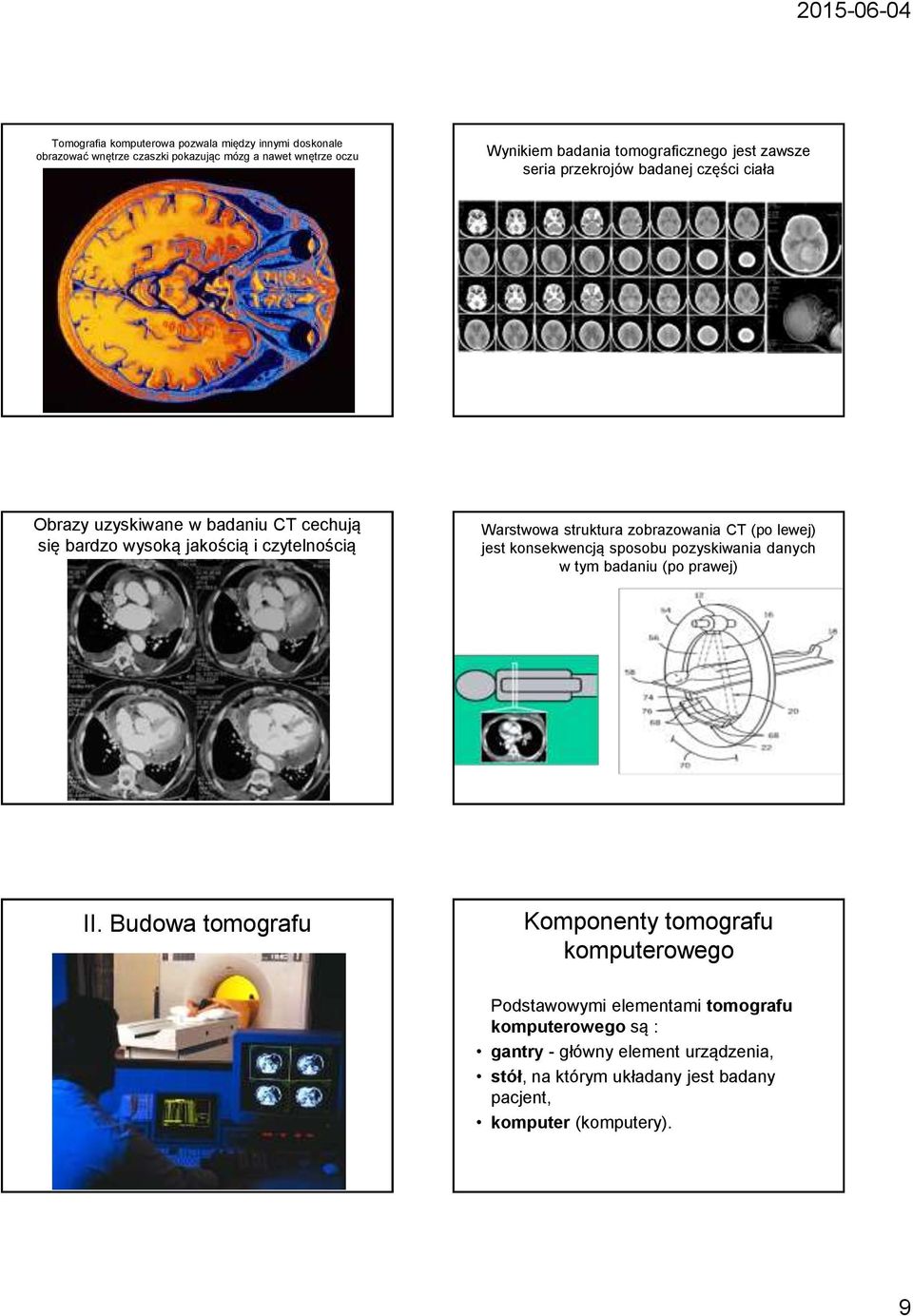zobrazowania CT (po lewej) jest konsekwencją sposobu pozyskiwania danych w tym badaniu (po prawej) II.