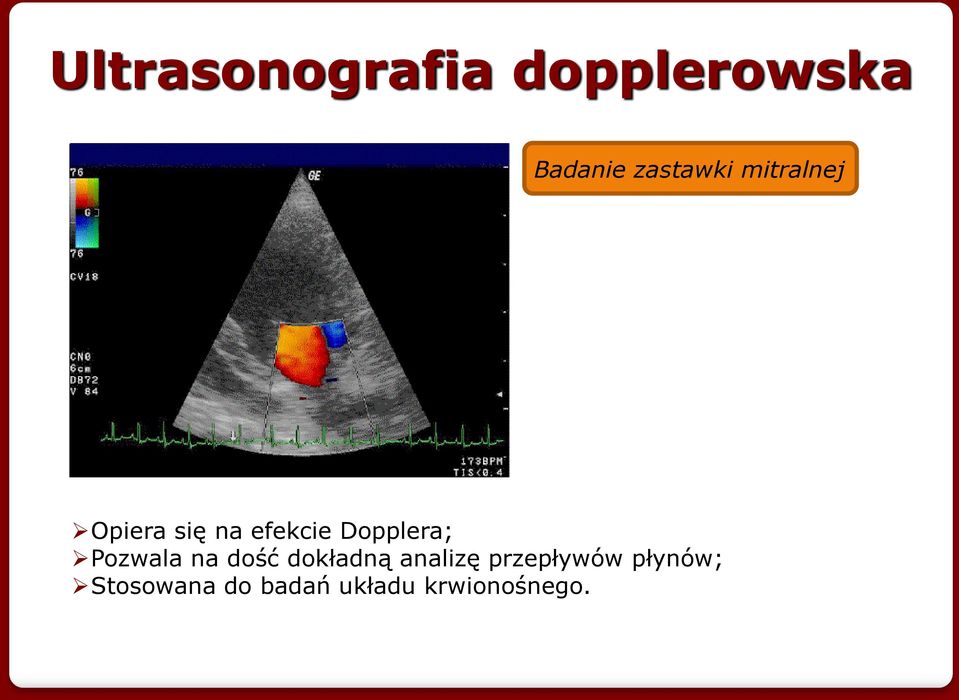 Dopplera; Pozwala na dość dokładną analizę