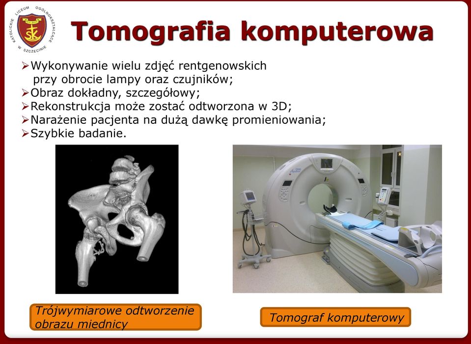 zostać odtworzona w 3D; Narażenie pacjenta na dużą dawkę promieniowania;