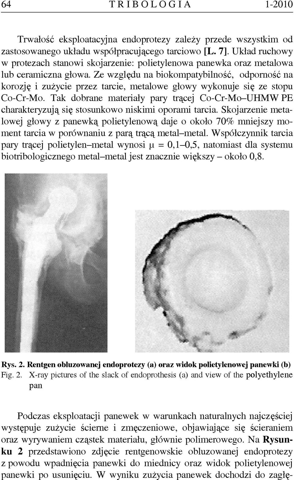 Ze względu na biokompatybilność, odporność na korozję i zużycie przez tarcie, metalowe głowy wykonuje się ze stopu Co-Cr-Mo.